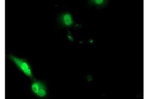 Anti-EPM2AIP1 mouse monoclonal antibody (ABIN2452994) immunofluorescent staining of COS7 cells transiently transfected by pCMV6-ENTRY EPM2AIP1 (RC209239). (EPM2AIP1 Antikörper)