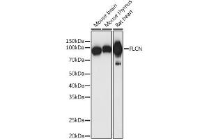 Western blot analysis of extracts of various cell lines, using FLCN antibody (ABIN7267226) at 1:1000 dilution. (FLCN Antikörper  (AA 1-130))