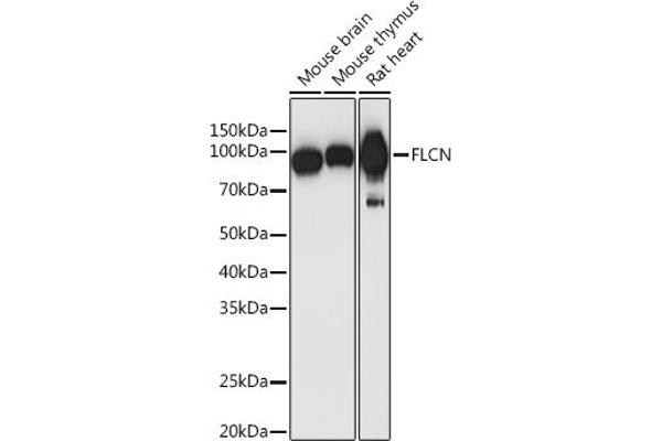 FLCN 抗体  (AA 1-130)