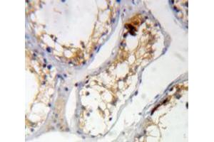 Used in DAB staining on fromalin fixed paraffin-embedded Testis tissue (KIAA1524 Antikörper  (AA 230-560))