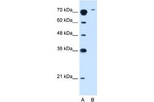 WB Suggested Anti-SLC7A14 Antibody Titration:  2. (SLC7A14 Antikörper  (N-Term))