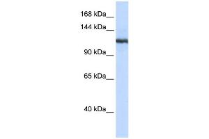 WB Suggested Anti-PLA2G4B Antibody Titration:  0. (PLA2G4B Antikörper  (N-Term))