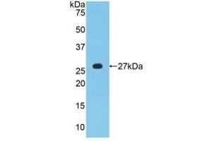 Detection of Recombinant MPZ, Human using Polyclonal Antibody to Protein Zero, Myelin (MPZ) (MPZ Antikörper  (AA 30-248))