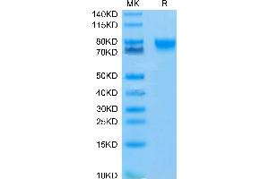 IL4 Receptor Protein (AA 24-232) (Fc Tag)