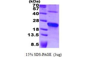 SDS-PAGE (SDS) image for Syndecan 4 (SDC4) (AA 19-145) protein (ABIN668053)