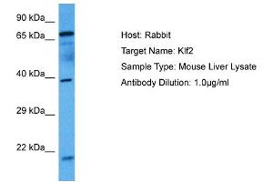 Host: Mouse Target Name: KLF2 Sample Tissue: Mouse Liver Antibody Dilution: 1ug/ml