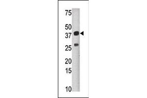 Western blot analysis of anti-SULT1C2 Pab (ABIN389140 and ABIN2839315) in mouse liver tissue lysate (35 μg/lane). (SULT1C2 Antikörper  (N-Term))