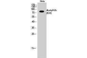 Western Blotting (WB) image for anti-Ubiquitin (Ubiquitin) (acLys33) antibody (ABIN3181498) (Ubiquitin Antikörper  (acLys33))