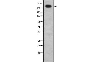 ABCA12 antibody  (C-Term)