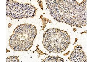 ABIN7095984 and ABIN7100046 at 1/100 staining mouse testis tissue by IHC-P. (BCL2-Like 15 Antikörper)