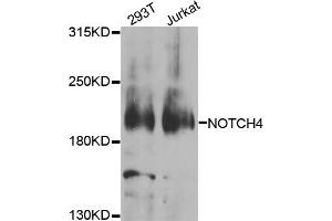 Western blot analysis of extracts of various cell lines, using NOTCH4 antibody (ABIN5974822) at 1/1000 dilution. (NOTCH4 Antikörper)