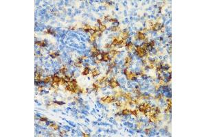 Immunohistochemistry of paraffin-embedded rat spleen using CD3D antibody (ABIN3021813, ABIN3021814, ABIN3021815 and ABIN6215992) at dilution of 1:200 (40x lens). (CD3D Antikörper  (AA 22-105))