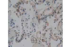Used in DAB staining on fromalin fixed paraffin- embedded lung tissue (CENPJ Antikörper  (AA 1-207))