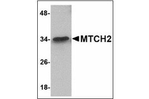 Western blot analysis of MTCH2 in 293 cell lysate with MTCH2 antibody at 1 µg/ml. (MTCH2 Antikörper  (N-Term))