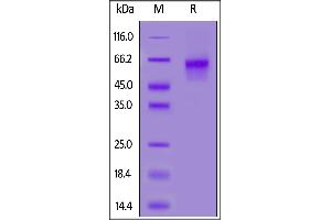 SDS-PAGE (SDS) image for Interleukin 6 Receptor, alpha (IL6RA) (AA 20-357) (Active) protein (His tag,AVI tag,Biotin) (ABIN6973130)