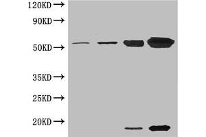 Western blot All lanes: Ribulose-1,5-bisphosphate carboxylase oxygenase antibody at 5 μg/mL Lane 1: Ribulose-1,5-bisphosphate carboxylase oxygenase at 0. (RuBisCO Activase Antikörper)