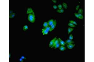 Immunofluorescent analysis of HepG2 cells using ABIN7141994 at dilution of 1:100 and Alexa Fluor 488-congugated AffiniPure Goat Anti-Rabbit IgG(H+L) (MICAL2 Antikörper  (AA 1-495))