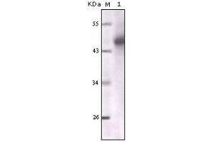Western blot analysis using CK mouse mAb against truncated CK5 recombinant protein. (Cytokeratin 1 Antikörper)