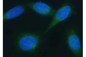 IF analysis of VAPA using anti-VAPA antibody (ABIN7603249). (VAPA Antikörper  (N-Term))