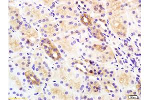 Formalin-fixed and paraffin embedded rat kidney labeled with Rabbit Anti Insulin Receptor Beta Polyclonal Antibody, Unconjugated (ABIN727340) at 1:200 followed by conjugation to the secondary antibody and DAB staining (ISR-beta Antikörper  (AA 1001-1100))