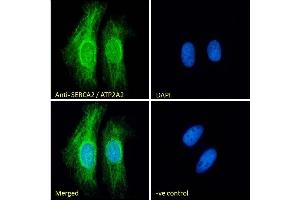 (ABIN1686784) mmunofluorescence analysis of paraformaldehyde fixed HeLa cells, permeabilized with 0. (ATP2A2 Antikörper  (Internal Region))