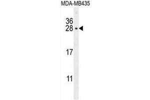 CSH1 Antibody (C-term) western blot analysis in MDA-MB435 cell line lysates (35µg/lane). (CSH1 Antikörper  (C-Term))