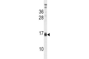 Western Blotting (WB) image for anti-Lactalbumin, alpha- (LALBA) antibody (ABIN2998275)