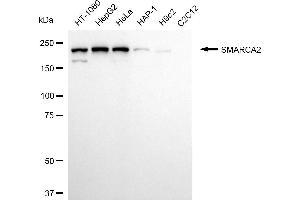 Western blotting analysis using SMARCA2 antibody (ABIN7800475).