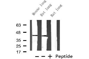 Western blot analysis of Histone PDGFRL expression in various lysates (PDGFRL Antikörper  (Internal Region))
