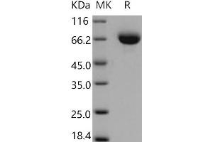 Western Blotting (WB) image for Endoglin (ENG) (Active) protein (His tag) (ABIN7320288) (Endoglin Protein (ENG) (His tag))