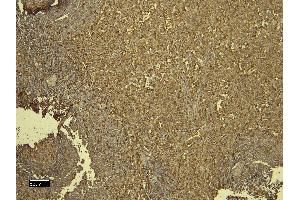 Immunohistochemistry (IHC) image for anti-Ionized Calcium-binding Adapter Molecule 1 (IBA1) (C-Term) antibody (ABIN184738)