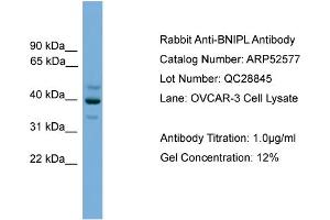 WB Suggested Anti-BNIPL  Antibody Titration: 0.