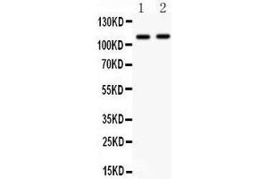 Western Blotting (WB) image for anti-Nucleotide-Binding Oligomerization Domain Containing 1 (NOD1) (AA 1-160) antibody (ABIN3043890) (NOD1 Antikörper  (AA 1-160))