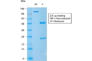 SDS-PAGE Analysis Purified CD1a Mouse Recombinant Monoclonal Antibody (rC1A/711). (Rekombinanter CD1a Antikörper)