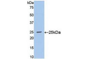 Detection of Recombinant RALA, Human using Polyclonal Antibody to V-Ral Simian Leukemia Viral Oncogene Homolog A (RALA) (rala Antikörper  (AA 1-206))