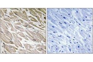 Immunohistochemistry analysis of paraffin-embedded human heart, using PPP1R2 (Phospho-Ser120+Ser121) Antibody. (PPP1R2 Antikörper  (pSer120))