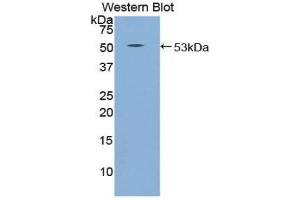 Western Blotting (WB) image for anti-Sema Domain, Immunoglobulin Domain (Ig), Transmembrane Domain (TM) and Short Cytoplasmic Domain, (Semaphorin) 4B (SEMA4B) (AA 644-832) antibody (ABIN1860523) (SEMA4B Antikörper  (AA 644-832))