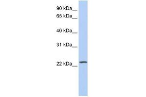 WB Suggested Anti-PIP5KL1 Antibody Titration: 0.