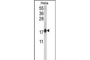 Calmodulin 1 Antikörper  (C-Term)