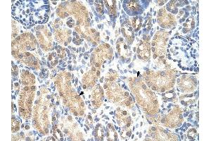 PRMT1 antibody was used for immunohistochemistry at a concentration of 4-8 ug/ml to stain Epithelial cells of renal tubule (arrows) in Human Kidney. (PRMT1 Antikörper  (Middle Region))