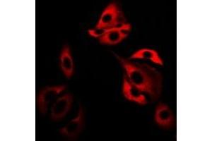 Immunofluorescent analysis of Glutaredoxin staining in SW480 cells.