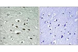 Immunohistochemistry analysis of paraffin-embedded human brain, using Chk1 (Phospho-Ser296) Antibody.