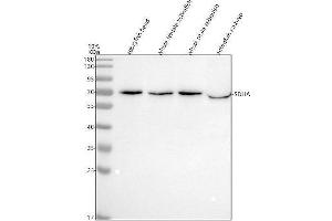 Western blot analysis of SDHA using anti-SDHA antibody (AZQ7ZVF3).