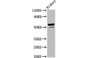 Western Blot Positive WB detected in: Rat kidney tissue All lanes: CYP8B1 antibody at 6. (CYP8B1 Antikörper  (AA 303-440))