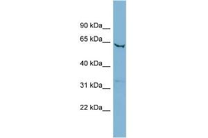 WB Suggested Anti-SLC25A21 Antibody Titration:  0. (SLC25A21 Antikörper  (Middle Region))