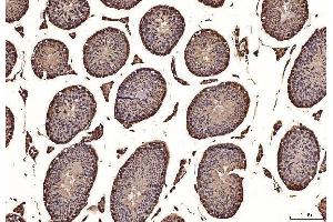 IHC analysis of NAK/TBK1 using anti-NAK/TBK1 antibody (ABIN7599532). (TBK1 Antikörper  (AA 1-729))