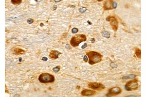 ABIN6257095 and ABIN6275980 at 1/100 staining Rat brain tissue by IHC-P.