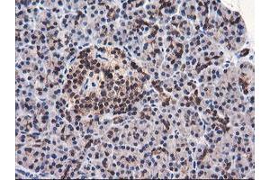 Image no. 4 for anti-F-Box Protein 21 (FBXO21) antibody (ABIN1498232) (FBXO21 Antikörper)