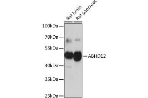 Western blot analysis of extracts of various cell lines, using  Rabbit pAb (ABIN7265355) at 1:1000 dilution.
