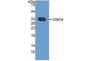Western blot analysis of recombinant Human CDK4.